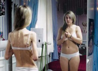 ¿Qué es la anorexia?