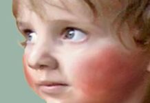 Cómo Reaccionar ante la Masturbación Infantil