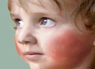 Cómo Reaccionar ante la Masturbación Infantil Cómo Reaccionar ante la Masturbación Infantil