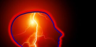 Epilepsia